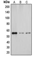 CYP2D6 Antibody (Internal)