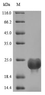 Human DOCK8 Protein (Recombinant 10His, N-terminus)