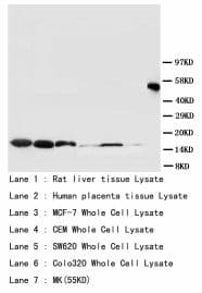 Superoxide Dismutase Antibody (aa113-129)