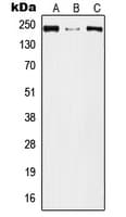 PLXNA2 / Plexin A2 Antibody (Internal)