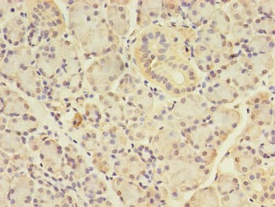 ANGPTL7 / CDT6 Antibody (aa27-296)