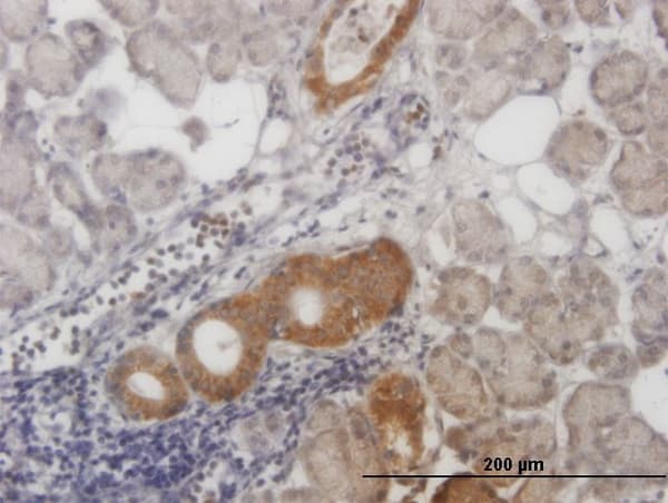 Monoclonal Mouse anti-Human CARF / ALS2CR8 Antibody (clone 2A3, IHC, IF, WB)