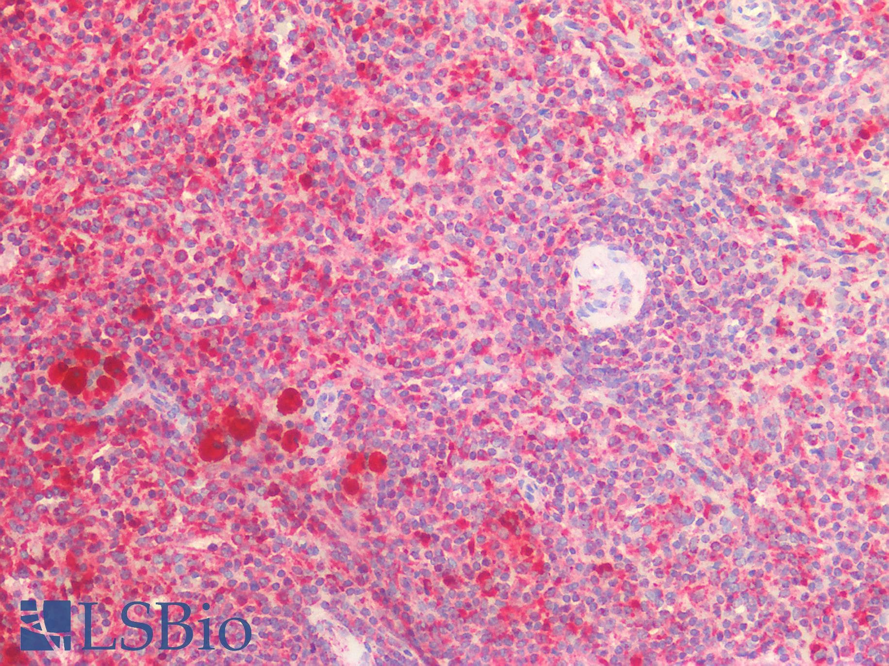 PathPlus™ CTSS / Cathepsin S Antibody