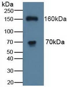 WC1 / ATP7B Antibody (aa59-426)