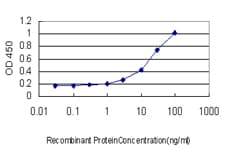 IHC-plus™ RBP4 Antibody (clone 4D9)