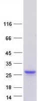 Human LCN2 / Lipocalin 2 / NGAL Protein (Recombinant Myc-DDK (Flag))