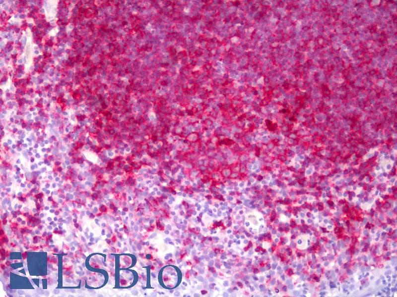 IHC-plus™ MHC Class II Antibody (clone TDR31.1)