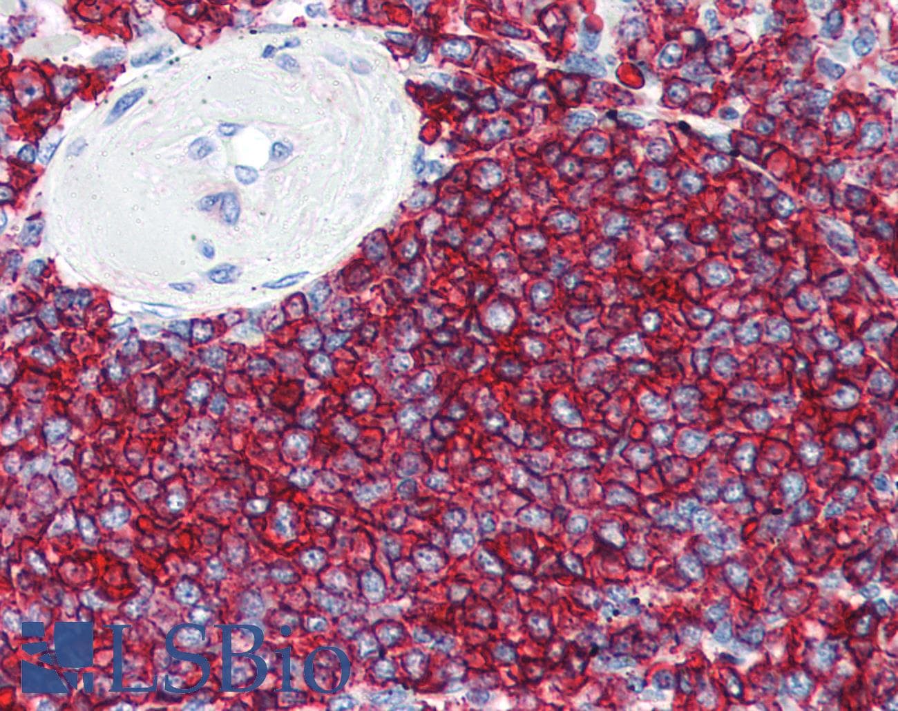 IHC-plus™ CD20 Antibody (C-Terminus)