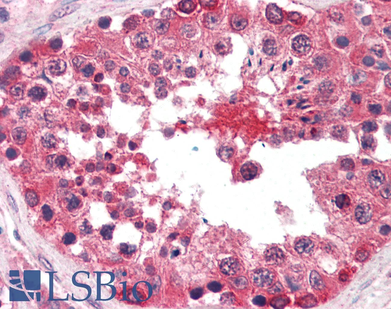 IHC-plus™ BRAF / B-Raf Antibody (clone 1H12F1)