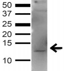 Polyclonal Rabbit anti-Human GABARAP Antibody (IF, WB)