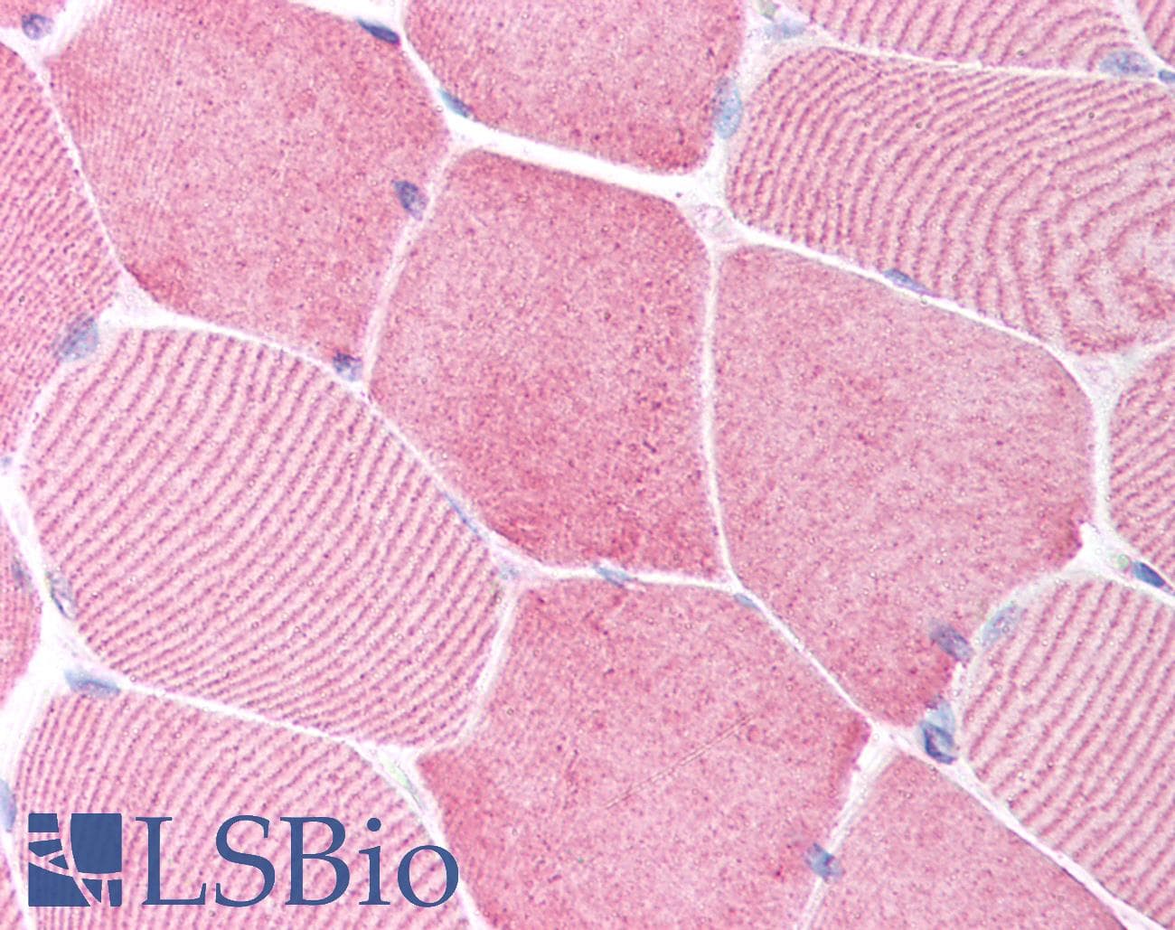 IHC-plus™ CASP6 / Caspase 6 Antibody