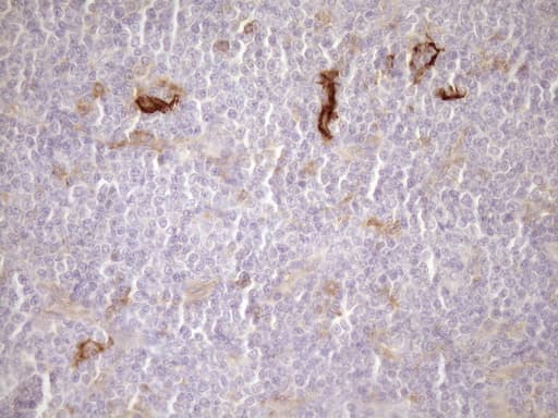 Monoclonal Mouse anti-Human CPM / Carboxypeptidase M Antibody (clone OTI1F8, aa124-423, IHC, WB)