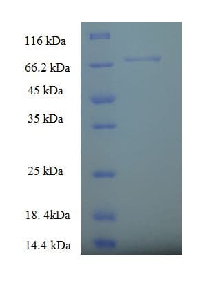 Human SPTLC2 / LCB2 Protein (Recombinant His-SUMO)