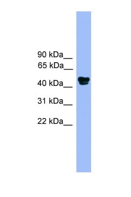 ALDH3A1 Antibody (aa51-100)