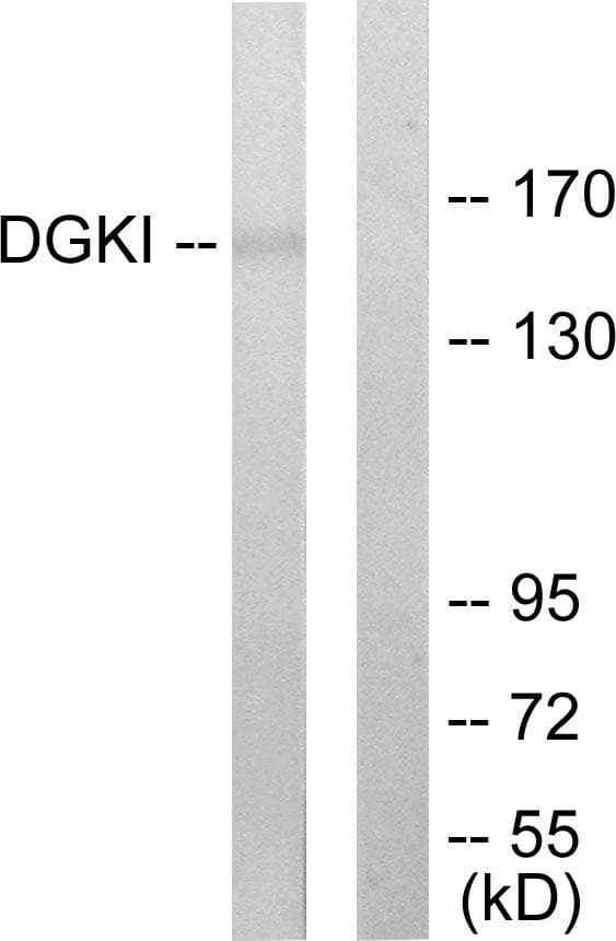 DGK-IOTA / DGKI Antibody