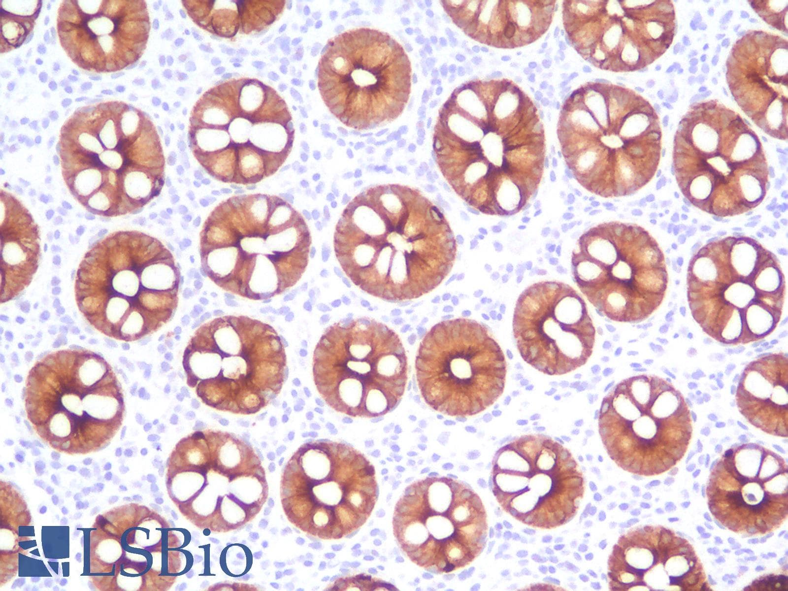PathPlus™ Monoclonal Mouse anti-Human KRT18 / CK18 / Cytokeratin 18 Antibody (Concentrated, IHC)