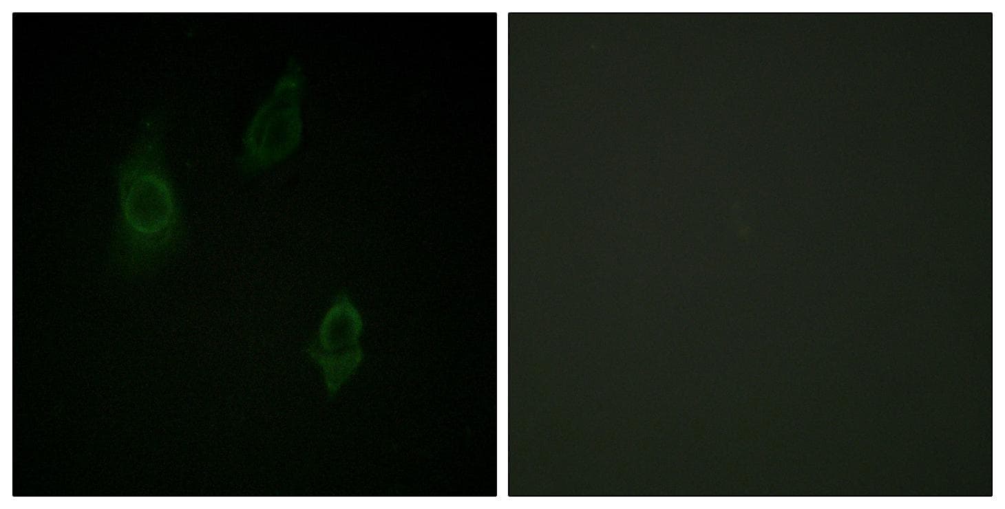 PKC / Protein Kinase C Antibody (phospho-Thr497)