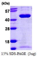 Human SEPT5 / Septin 5 Protein (Recombinant His)