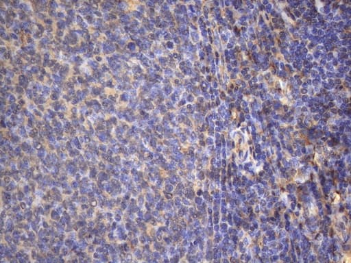 Monoclonal Mouse anti-Human MAP3K8 / TPL2 Antibody (clone OTI2E3, aa277-461, IHC, WB)
