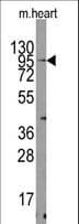 TRPV3 Antibody (aa90-119)
