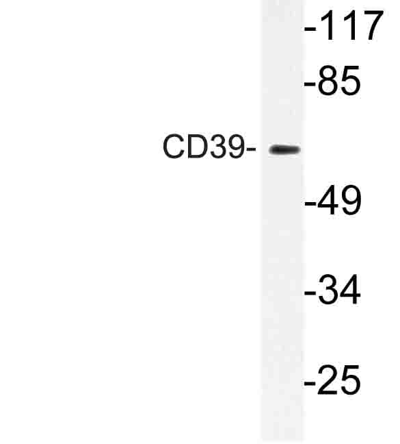 Polyclonal Rabbit anti-Human CD39 Antibody (Lys388, WB)