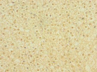 PLXNA2 / Plexin A2 Antibody