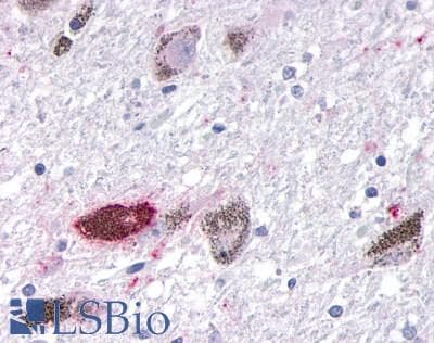 PathPlus™ OR10R2 Antibody (C-Terminus)