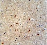 GTPBP8 / HSPC135 Antibody (aa122-150)