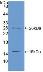 MKI67 / Ki67 Antibody (aa2815-2928)