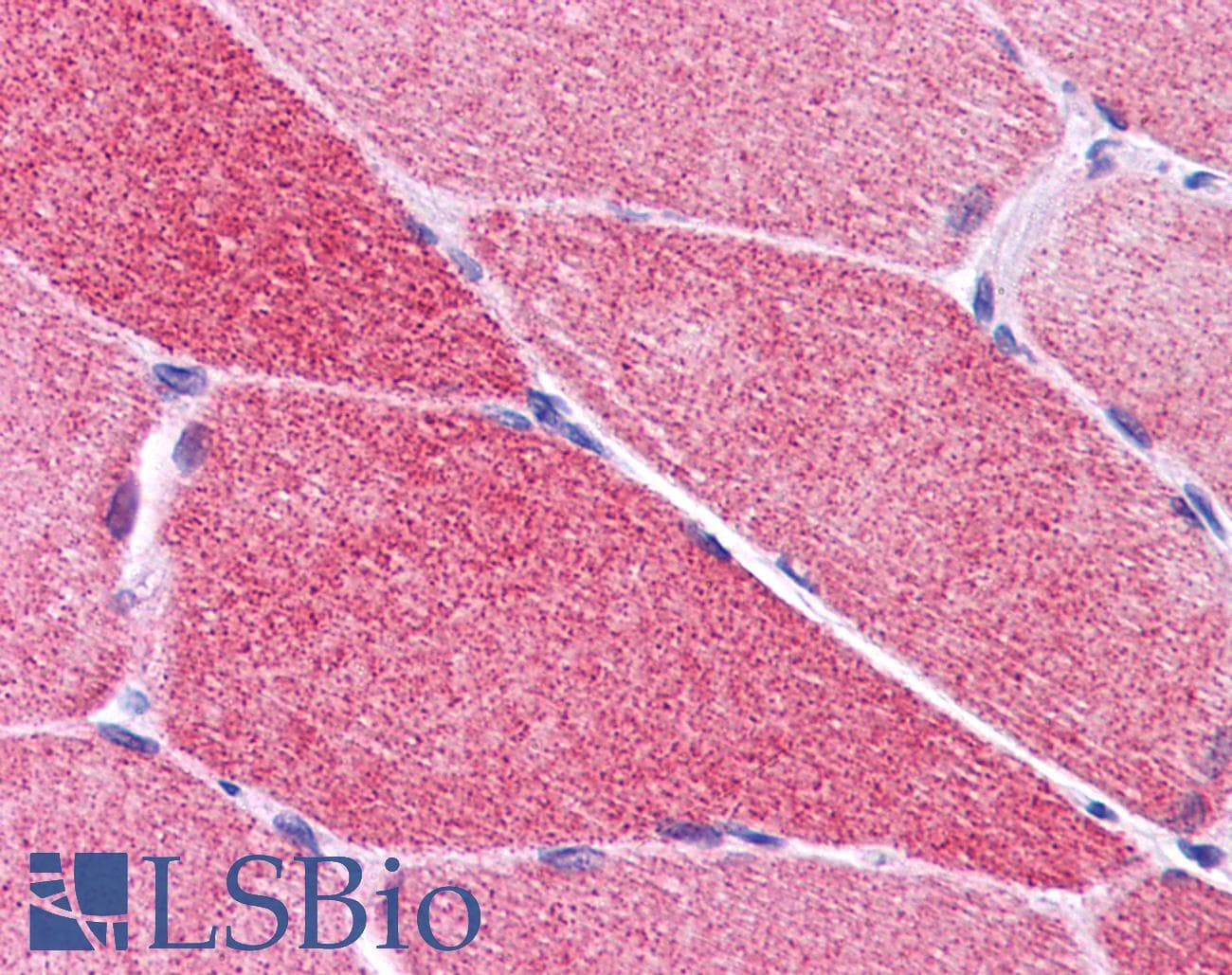 IHC-plus™ Polyclonal Rabbit anti-Human PLEKHM2 / SKIP Antibody (IHC, IF, WB)