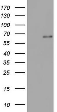IKZF3 / AIOLOS Antibody (aa1-301, clone OTI2B9, Carrier-free)