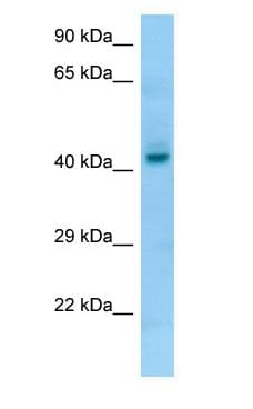 Polyclonal Rabbit anti-Human PGA4 Antibody (aa266-315, WB)