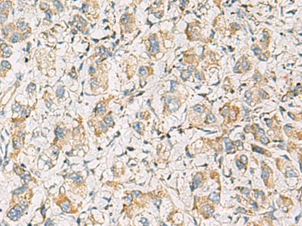 Polyclonal Rabbit anti-Human PDE4DIP / MMGL Antibody (IHC)