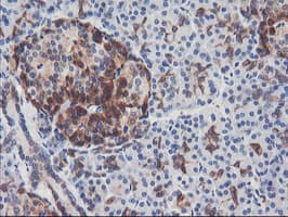 PFKP Antibody (clone OTI2E10)