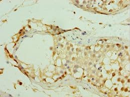 MAGEC2 / CT10 Antibody (aa1-150)