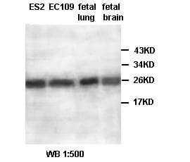 Polyclonal Rabbit anti-Human AKR1A1 Antibody (IHC, WB)
