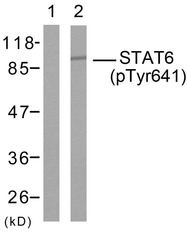 STAT6 Antibody (phospho-Tyr641)