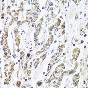 IL28B Antibody