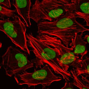 IHC-plus™ XRCC5 / Ku80 Antibody (clone 5C5)