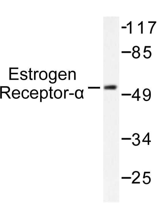 ER Alpha / Estrogen Receptor Antibody (His112)
