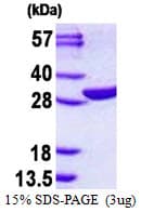 Human EMG1 / NEP1 Protein (Recombinant His)