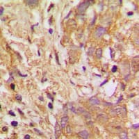 VEGFB Antibody (Internal)