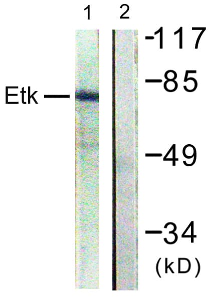 Polyclonal Rabbit anti-Human ETK / BMX Antibody (aa6-55, IHC, WB)