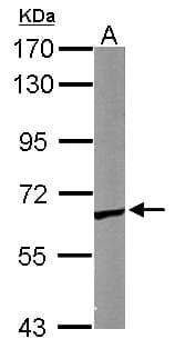CCT5 / TCP1 Epsilon Antibody (aa1-264)