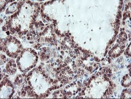 SERPINB1 Antibody (aa77-306, clone OTI2B4)