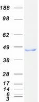 Human HIBCH Protein (Recombinant Myc-DDK (Flag))