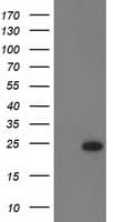 RGS5 Antibody (aa1-181, clone OTI1E3)