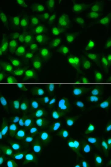 Polyclonal Rabbit anti-Human PPP3CA / CCN1 / Calcineurin A Antibody (IHC, IF, WB)
