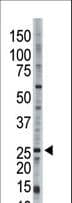 UBE2E3 Antibody (aa176-206)