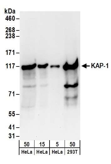 TRIM28 / KAP1 Antibody (aa1-50)